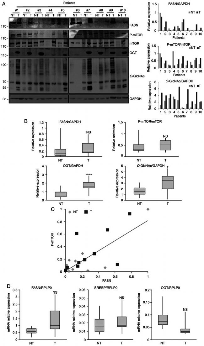 O-linked N-acetylglucosamine (O-GlcNAc) Antibody in Western Blot (WB)