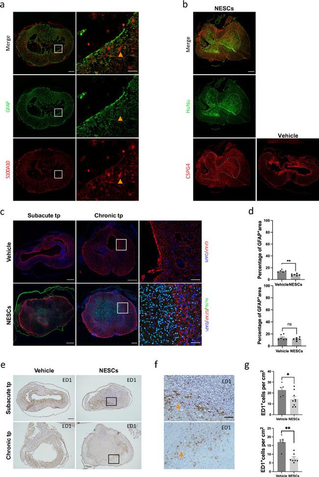 S100A10 Antibody in Immunohistochemistry (IHC)