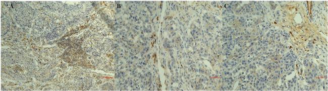 CD20 Antibody in Immunohistochemistry (IHC)