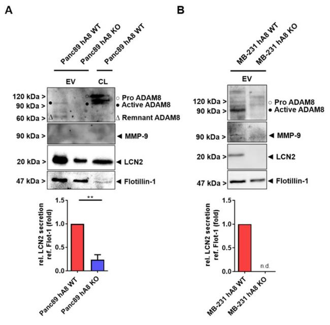 ADAM8 Antibody in Western Blot (WB)