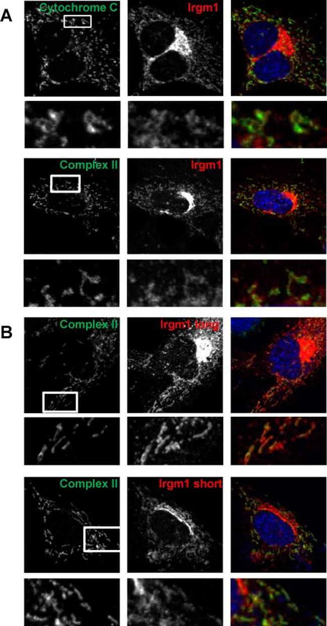 SDHA Antibody in Immunocytochemistry (ICC/IF)