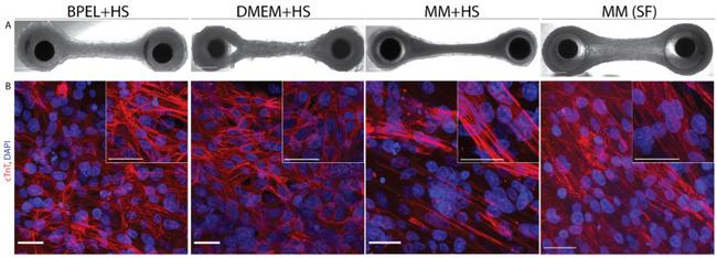 Cardiac Troponin T Antibody in Immunohistochemistry (PFA fixed) (IHC (PFA))