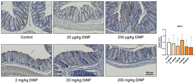 MUC1 Antibody in Immunohistochemistry (IHC)