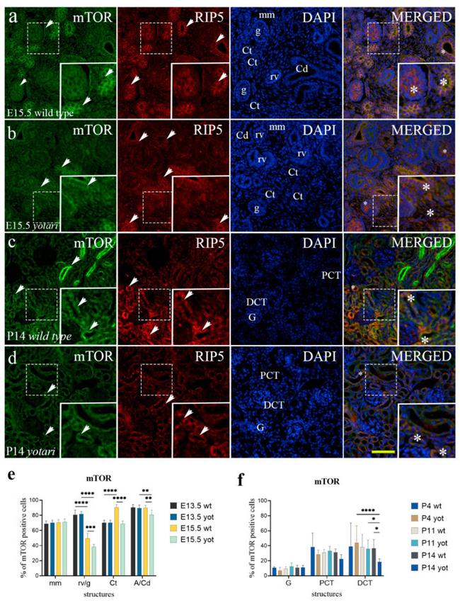 mTOR Antibody in Immunohistochemistry (IHC)