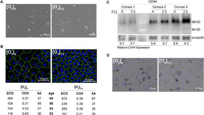 ZO-1 Antibody in Immunocytochemistry (ICC/IF)