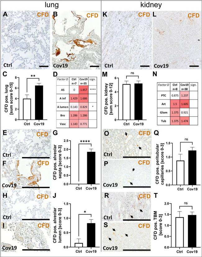 Factor D Antibody in Immunohistochemistry (IHC)