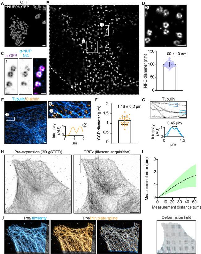 Clathrin Heavy Chain Antibody in Immunocytochemistry (ICC/IF)