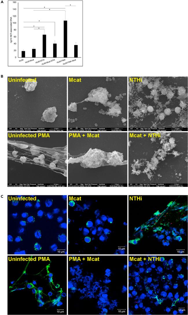 Myeloperoxidase Antibody in Immunocytochemistry (ICC/IF)