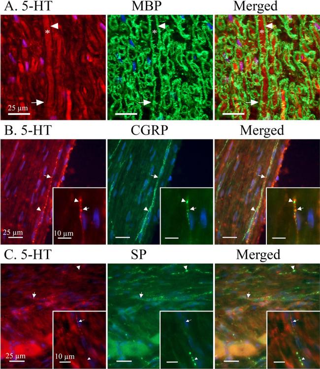 MBP Antibody in Immunohistochemistry (IHC)