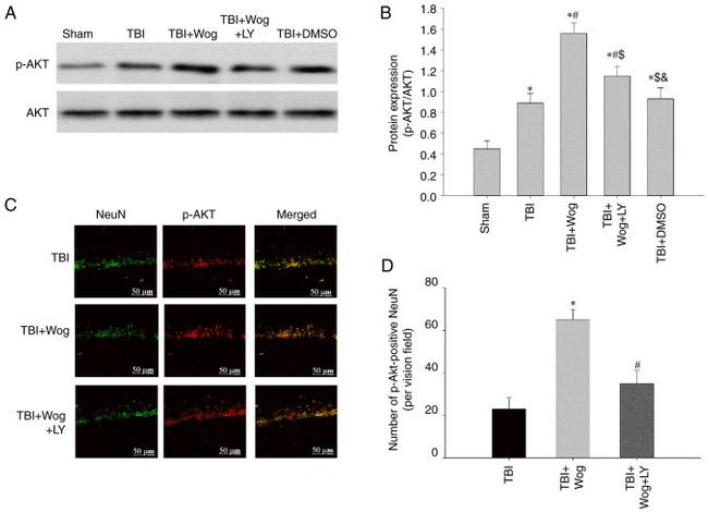 AKT1 Antibody in Western Blot (WB)