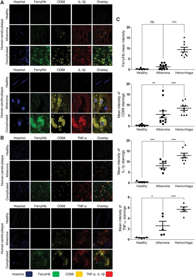 IL-1 beta Antibody in Immunohistochemistry (Paraffin) (IHC (P))