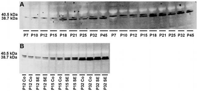 Adenosine Kinase Antibody in Western Blot (WB)