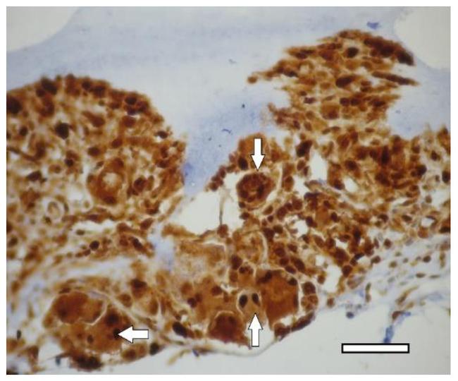 PCNA Antibody in Immunohistochemistry (IHC)