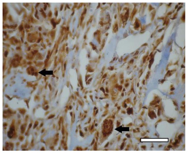 PCNA Antibody in Immunohistochemistry (IHC)