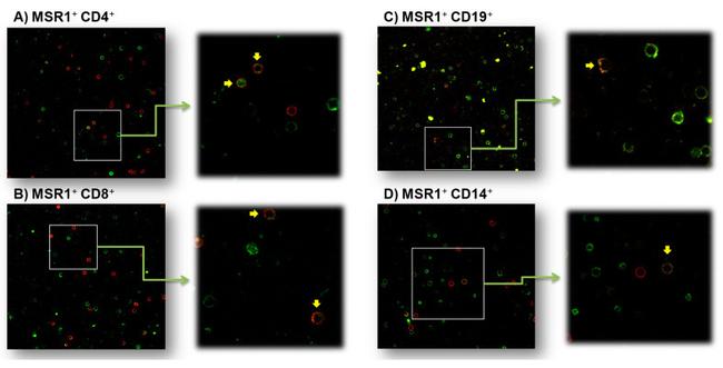 CD204 Antibody in Immunocytochemistry (ICC/IF)