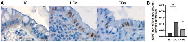 ATF3 Antibody in Immunohistochemistry (Paraffin) (IHC (P))