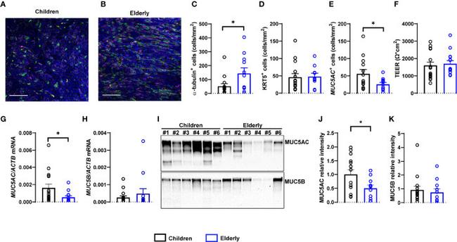 MUC5AC Antibody in Western Blot (WB)