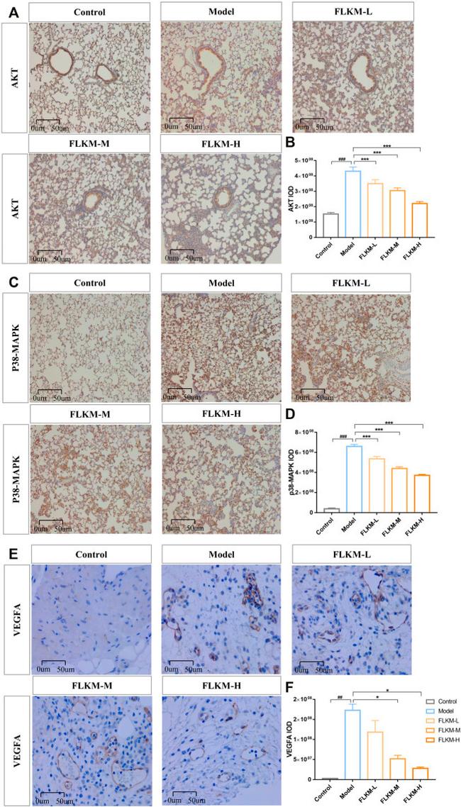 VEGFA Antibody in Immunohistochemistry (IHC)