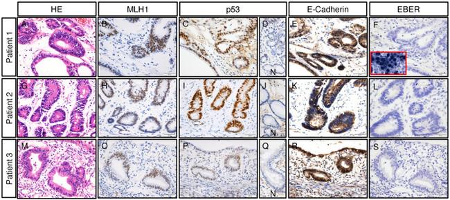 p53 Antibody in Immunohistochemistry (IHC)