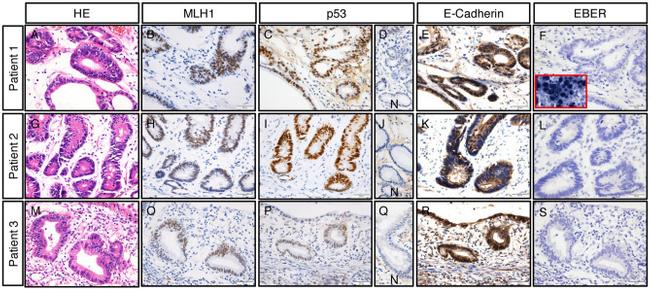 MLH1 Antibody in Immunohistochemistry (IHC)