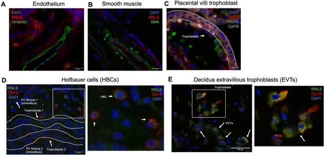 Vimentin Antibody in Immunohistochemistry (Paraffin) (IHC (P))