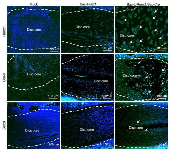 RUNX1 Antibody in Immunohistochemistry (IHC)