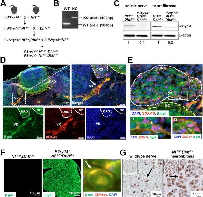 beta Galactosidase Antibody in Immunohistochemistry (IHC)