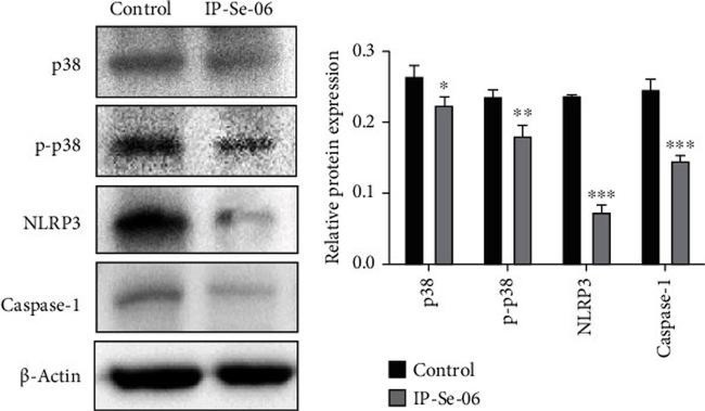 Caspase 1 Antibody in Western Blot (WB)