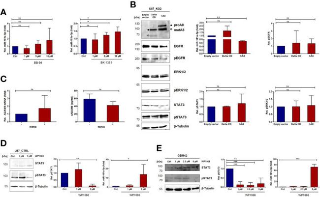 ADAM8 Antibody in Western Blot (WB)