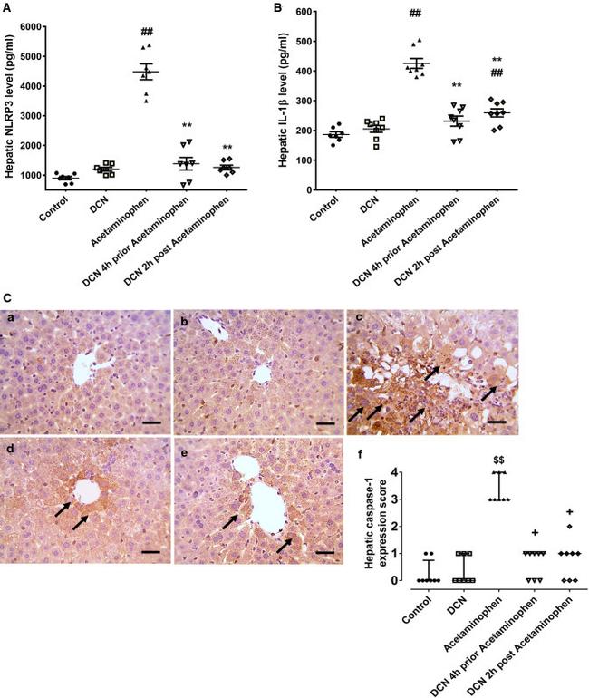 Caspase 1 Antibody in Immunohistochemistry (IHC)