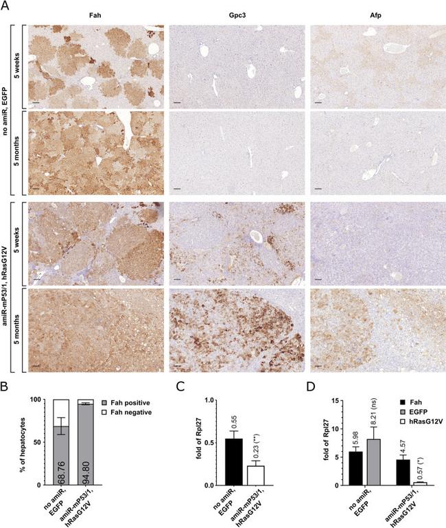 FAH Antibody in Immunohistochemistry (IHC)