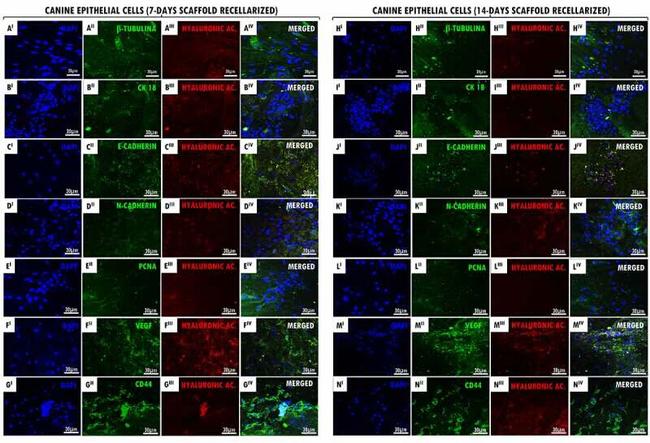 PCNA Antibody in Immunocytochemistry (ICC/IF)