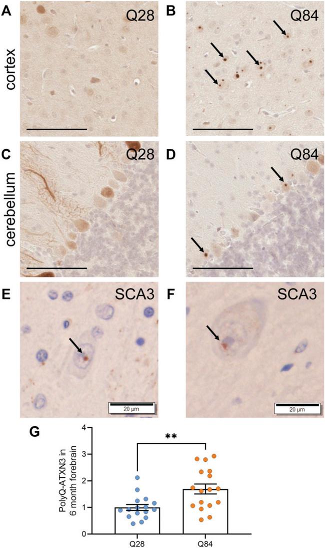 Ataxin 3 Antibody in Immunohistochemistry (IHC)