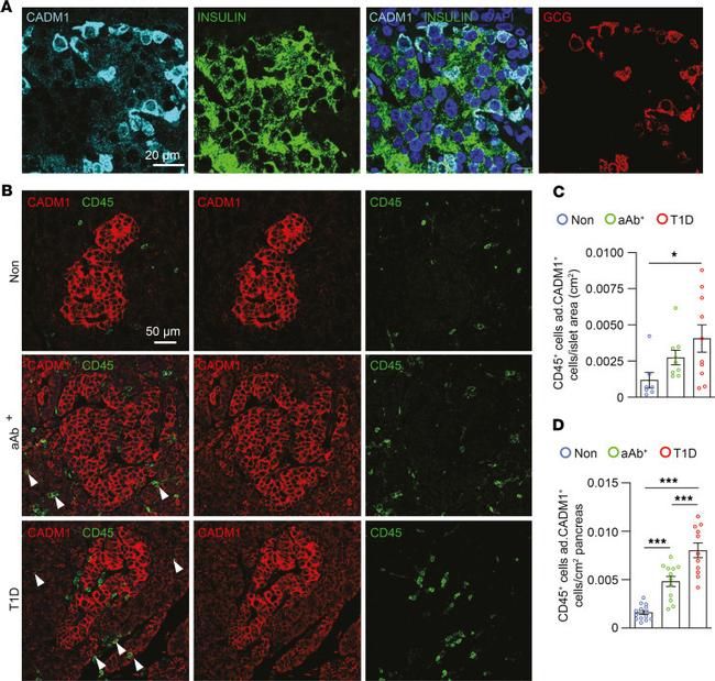 Insulin Antibody in Immunohistochemistry (IHC)