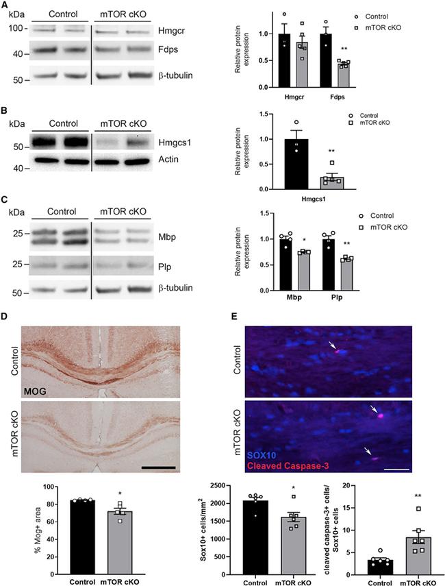 HMGCR Antibody in Western Blot (WB)