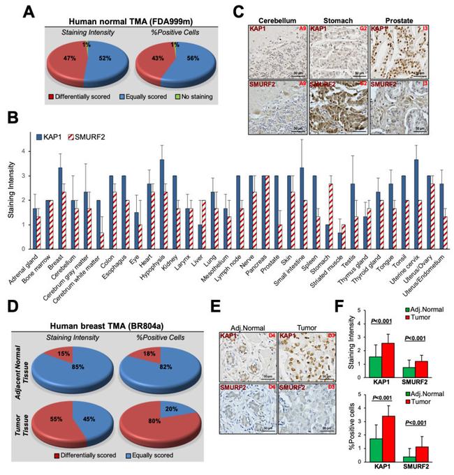 TRIM28 Antibody in Immunohistochemistry (IHC)