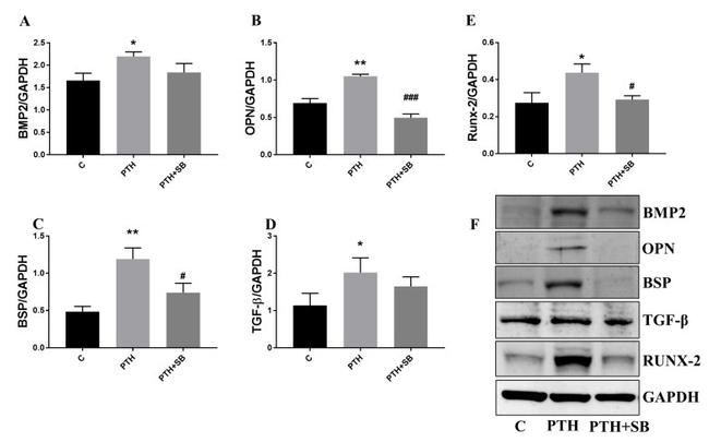 RUNX2 Antibody in Western Blot (WB)