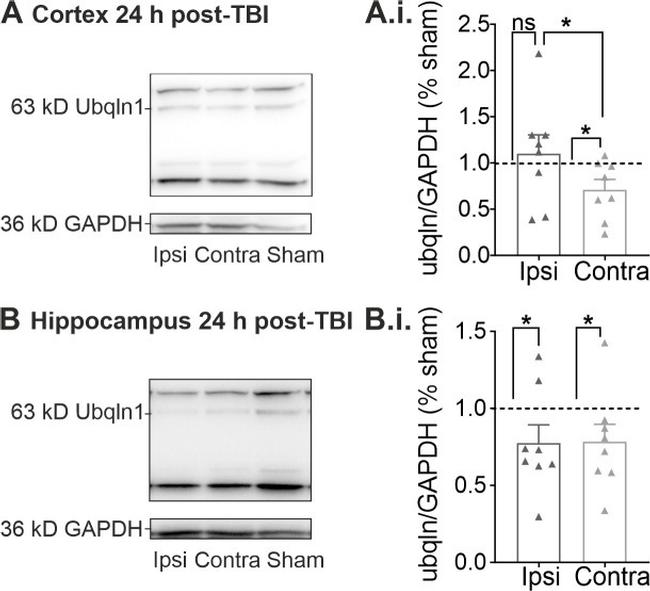 Ubiquilin 1 Antibody in Western Blot (WB)