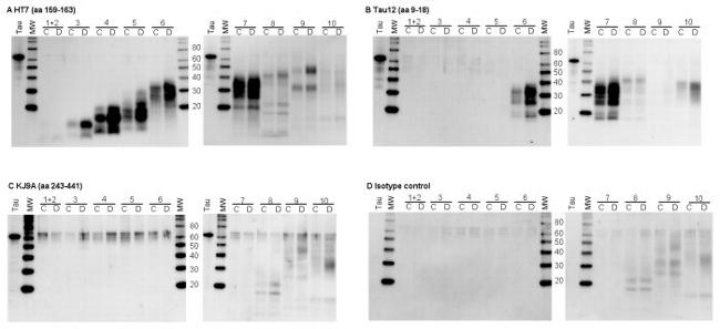 Tau Antibody in Western Blot (WB)