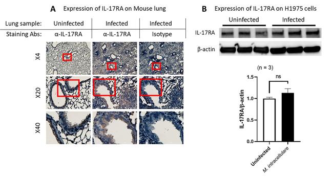 IL17RA Antibody in Western Blot, Immunohistochemistry (WB, IHC)