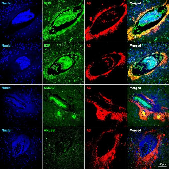 SMOC1 Antibody in Immunohistochemistry (IHC)