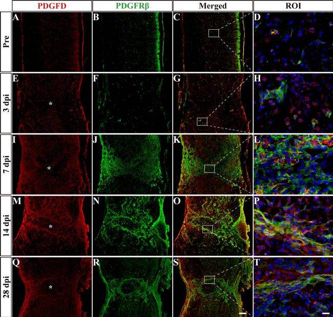 PDGF-D Antibody in Immunohistochemistry (IHC)