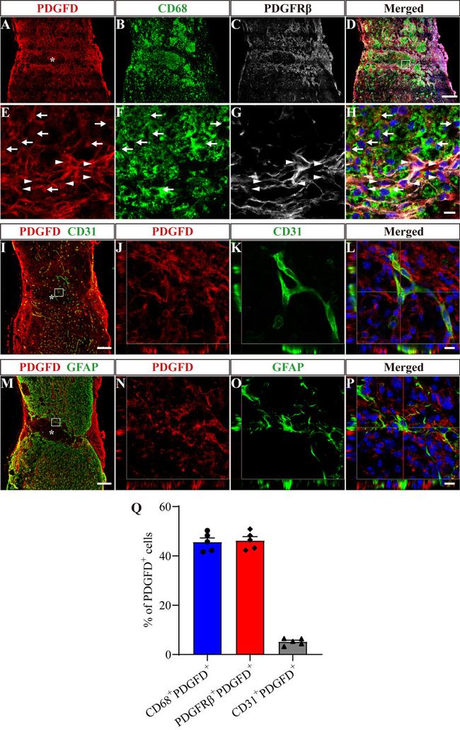 PDGF-D Antibody in Immunohistochemistry (IHC)