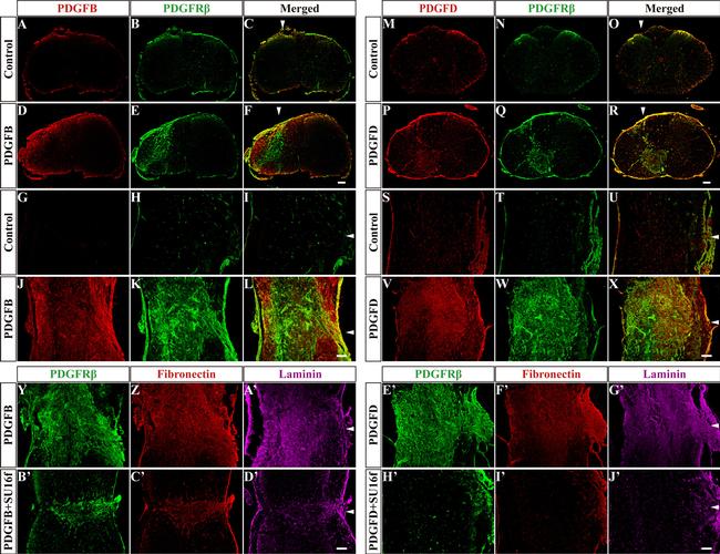 PDGF-D Antibody in Immunohistochemistry (IHC)