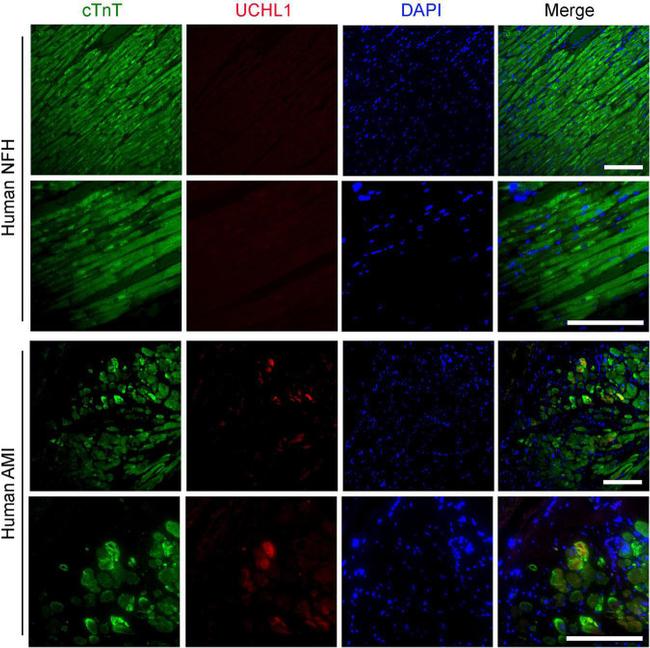 Cardiac Troponin T Antibody in Immunohistochemistry (IHC)