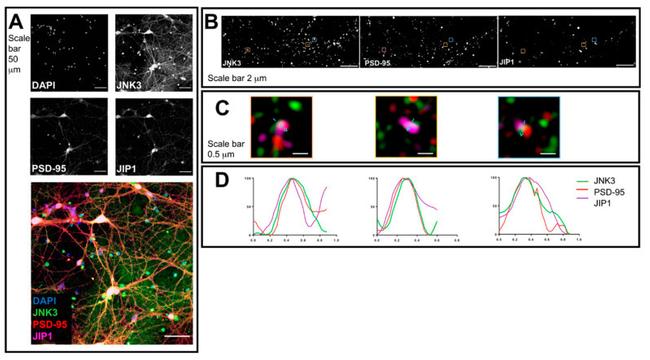 JNK3 Antibody in Immunocytochemistry (ICC/IF)