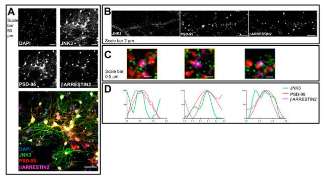 JNK3 Antibody in Immunocytochemistry (ICC/IF)