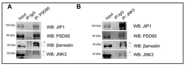 beta-Arrestin 2 Antibody in Western Blot (WB)