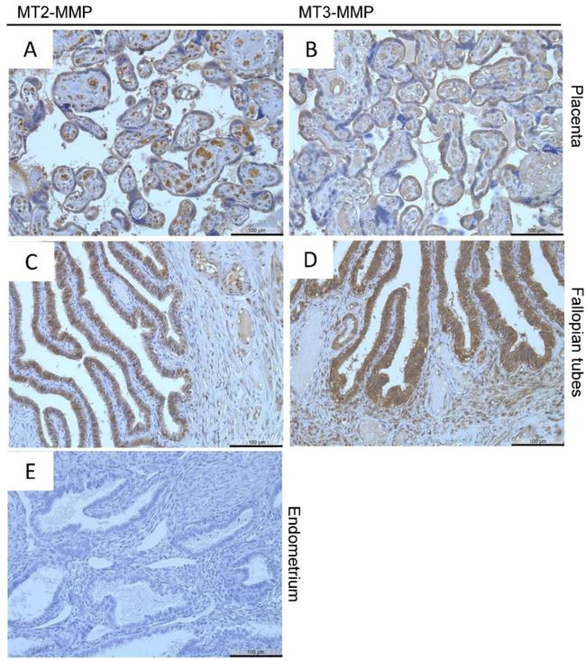 MMP16 Antibody in Immunohistochemistry (IHC)