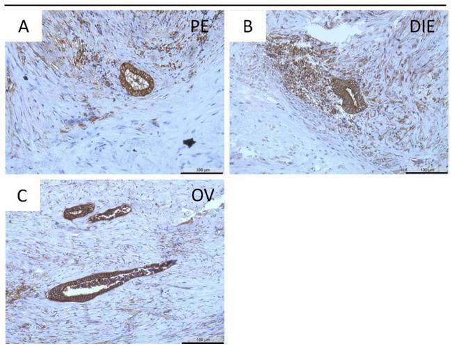 MMP16 Antibody in Immunohistochemistry (IHC)